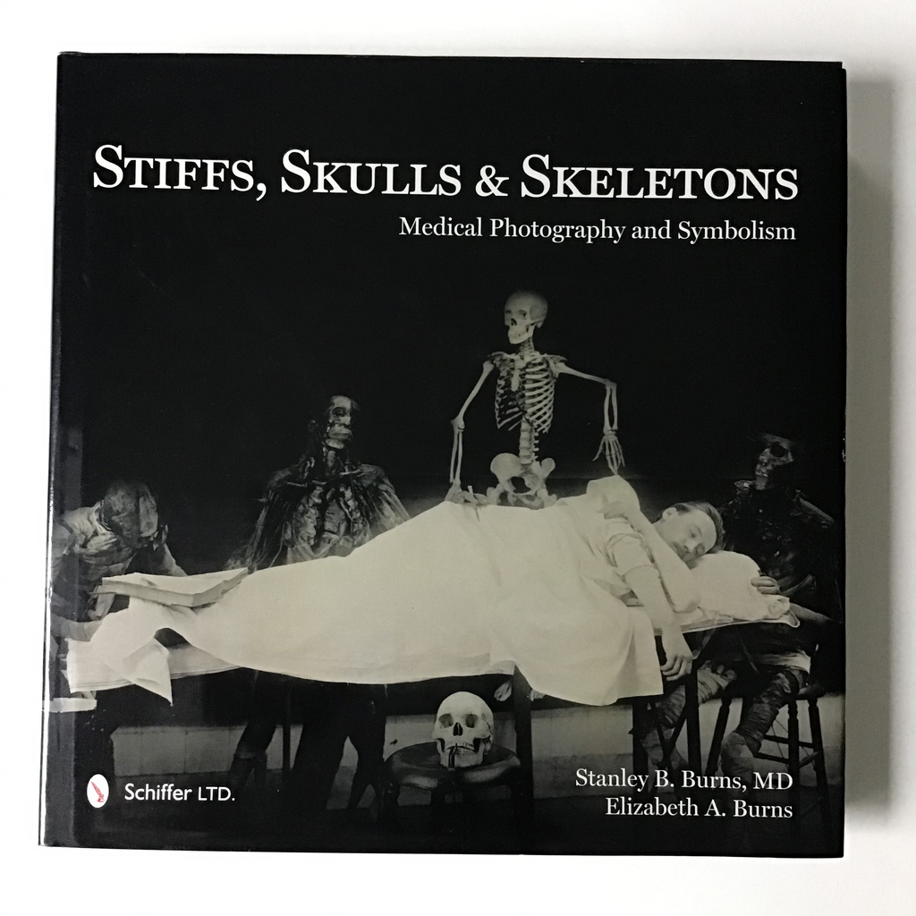 Stiffs, Skulls & Skeletons Burns medical archive